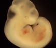 mouse embryo, day 11 of development