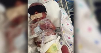 Doctors told Gideon’s mother to abort him, but she refused; now she can’t imagine life without him
