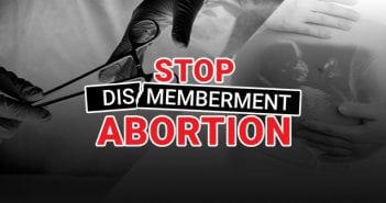 The Pro-Life movement must force SCOTUS to face dismemberment abortions.